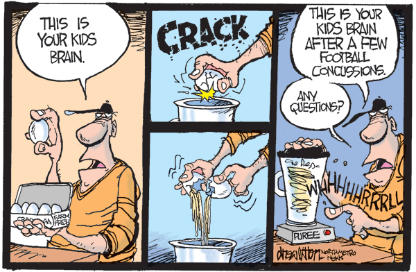 concussions